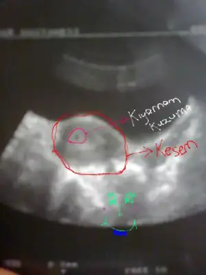 $kuzum.webp
