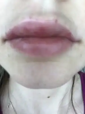 image.webp
