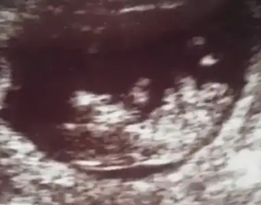 2017-06-03 10.53.20.webp