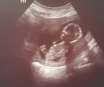 2017-06-10 10.17.44.webp