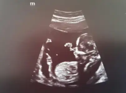 2017-06-10 10.17.23.webp