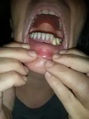 IMG-20170815-WA0007.webp