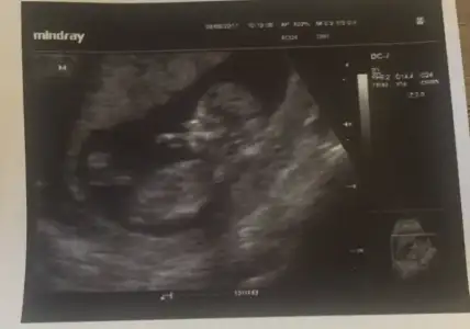 FullSizeRender (3).webp