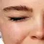 $Closed-eye.webp