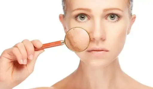 Güneş Lekelerini Geçiren Maske