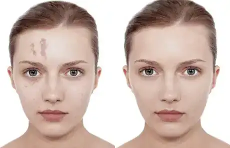 $vichy_dermablend.webp