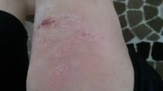 1511771738699.webp