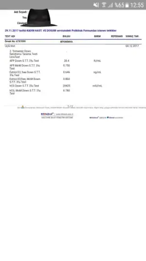 20171217_185204.webp