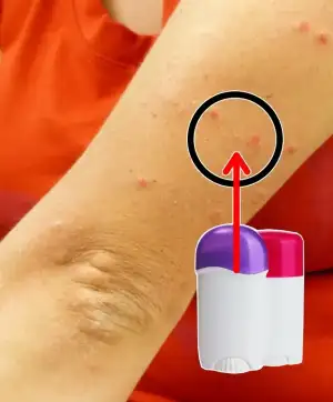 sivrisinek_isiriklari_icin.webp