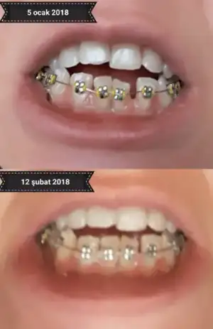 20180213_002619.webp
