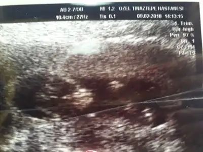 WhatsApp Image 2018-02-13 at 09.43.56.webp