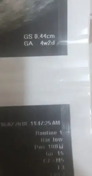20180217_223611.webp