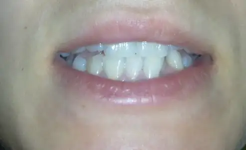 $150120121551.webp