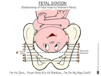 fetal_station1321413075594-e1427905318180.webp