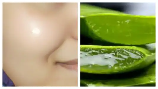 cilt_cizilmesi_maskesi_aloe_vera.webp