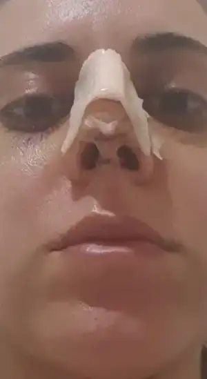 20180306_195623.webp