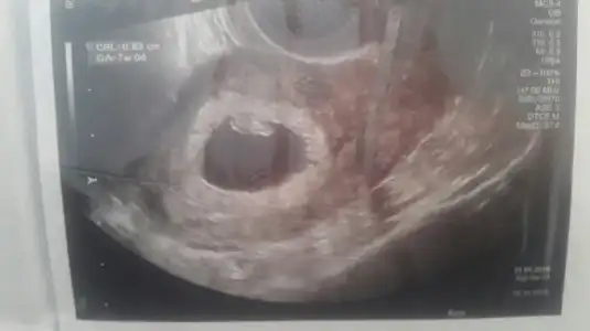 2018-03-17 18.01.15.webp