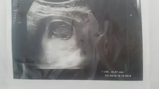 2018-03-17 18.00.37.webp