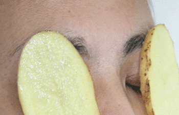 Patatesle_Arpacik_tedavisi.gif
