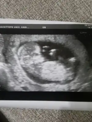 2018-04-26 22.19.27.webp