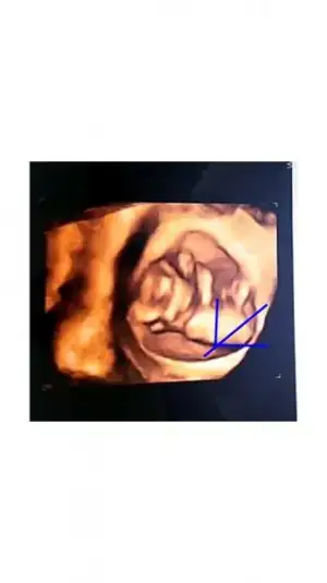 Project Capture.webp