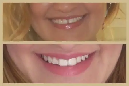 $K&#305;z &#304;steme Ni&#351;an.webp