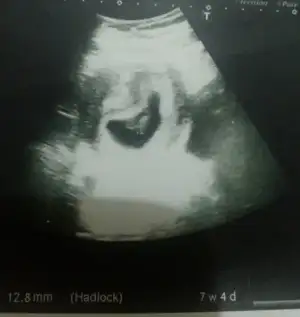 WhatsApp Image 2018-06-25 at 14.00.45.webp