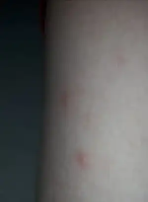 20180714_130017.webp