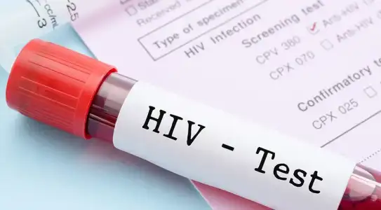 Anti HİV Non Reactive Ne Demek? Anti HIV Testi Sonucu