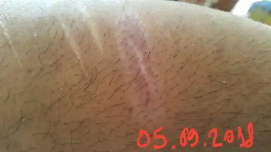 IMG-20180915-WA0005.webp