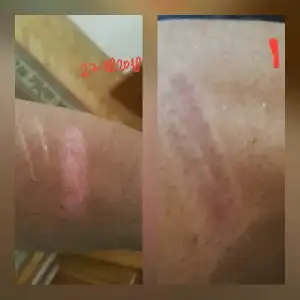 IMG-20180915-WA0001.webp