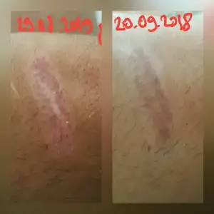IMG-20180920-WA0000.webp