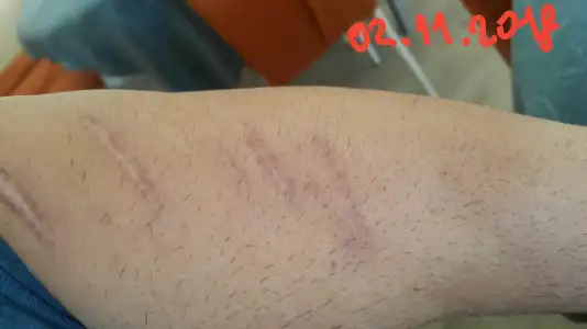 IMG-20181102-WA0007-1.webp