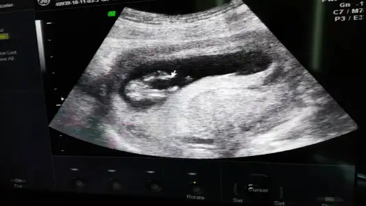 Screenshot_20181105-111609_Video Player.webp