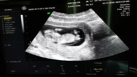 Screenshot_20181105-111635_Video Player.webp