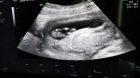 Screenshot_20181105-111603_Video Player.webp