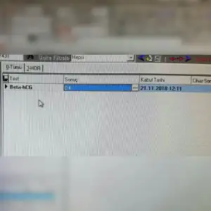 1542927695572.webp