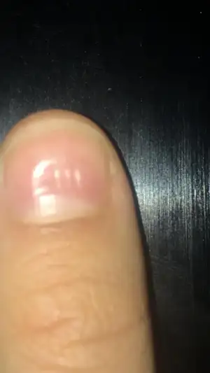 nail.webp