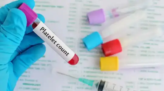 Yüksek PLT Bitkisel Tedavi Yöntemleri Nelerdir?