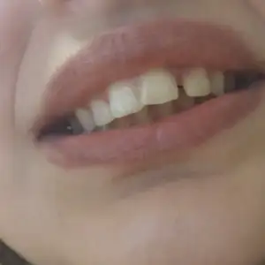 20181230_120624.webp