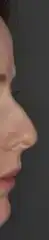 $önce_001.webp