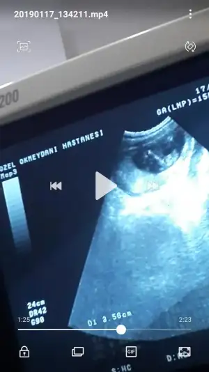 Screenshot_20190117-140416_Video Player.webp