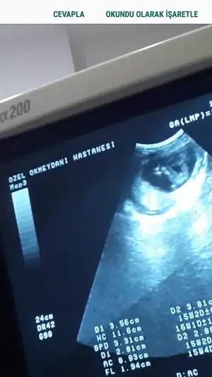 Screenshot_20190117-135637_Video Player.webp