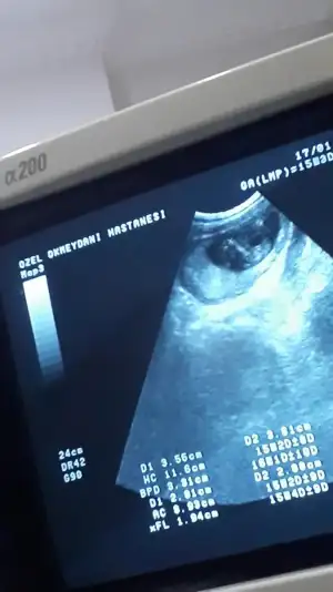 Screenshot_20190117-135201_Video Player.webp