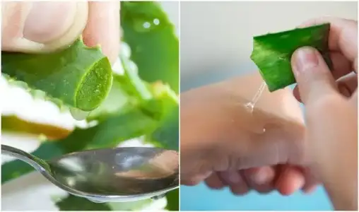 Aloe Vera’nın Cilde Faydaları Nelerdir? Cilt Lekelerini Geçirir Mi?