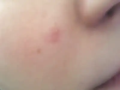 image.webp