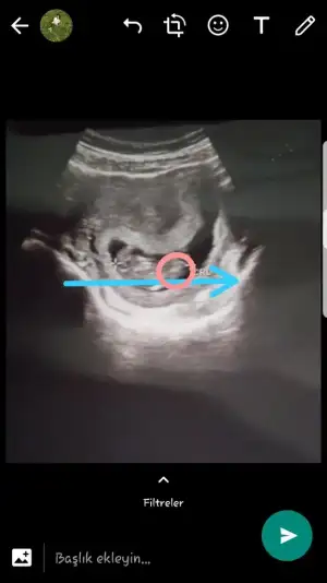 Screenshot_20190617-230249_WhatsApp.webp