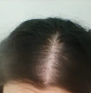 XbdJm6.webp
