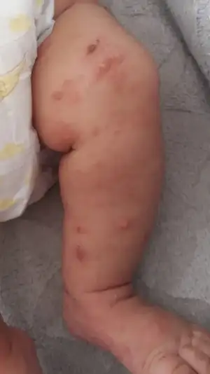 Screenshot_20190813-222530_Photos.webp