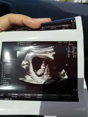 WhatsApp Image 2019-08-26 at 12.54.05 (1).webp